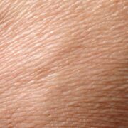 Regeneracja ludzkiej skóry. Jak przebiega?