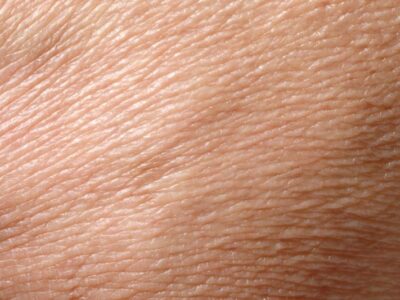 Regeneracja ludzkiej skóry. Jak przebiega?