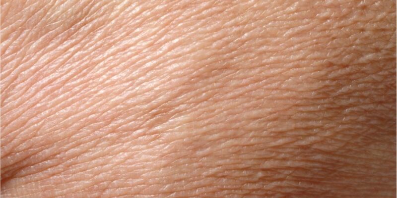 Regeneracja ludzkiej skóry. Jak przebiega?